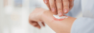 a person putting on wound cream on their wounded arm for soothing