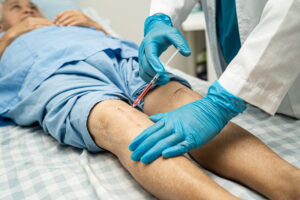 Hyaluronic acid injection