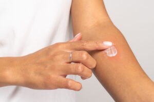 Wound healing gel